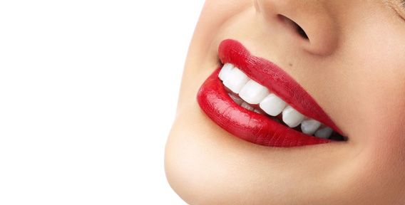 Франшиза Brilliant Smile - косметическое отбеливание зубов
