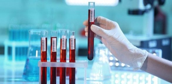 Медицинская лаборатория. Стоит ли открывать свой бизнес?