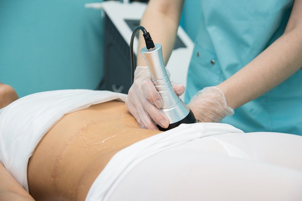 Франшиза Body Life - студия моделирования фигуры