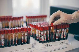 Медицинская лаборатория. Стоит ли открывать свой бизнес?